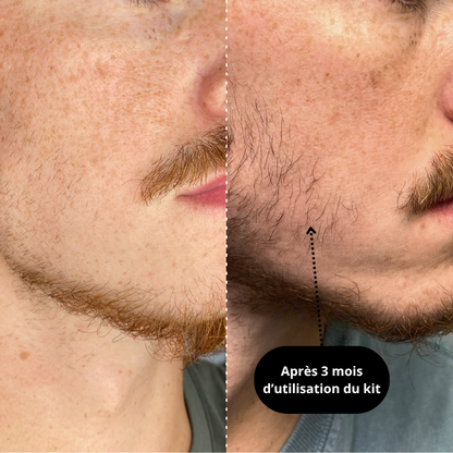 KIT CROISSANCE DE BARBE - APOLLO